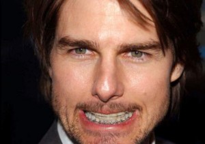 Photo de Tom Cruise avec un appareil dentaire